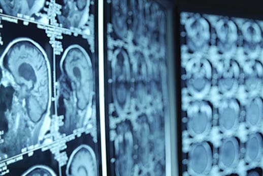 Kauno kolegijoje pradedamos Radiologijos studijos Kauno kolegijoje pradedamos Radiologijos studijos
